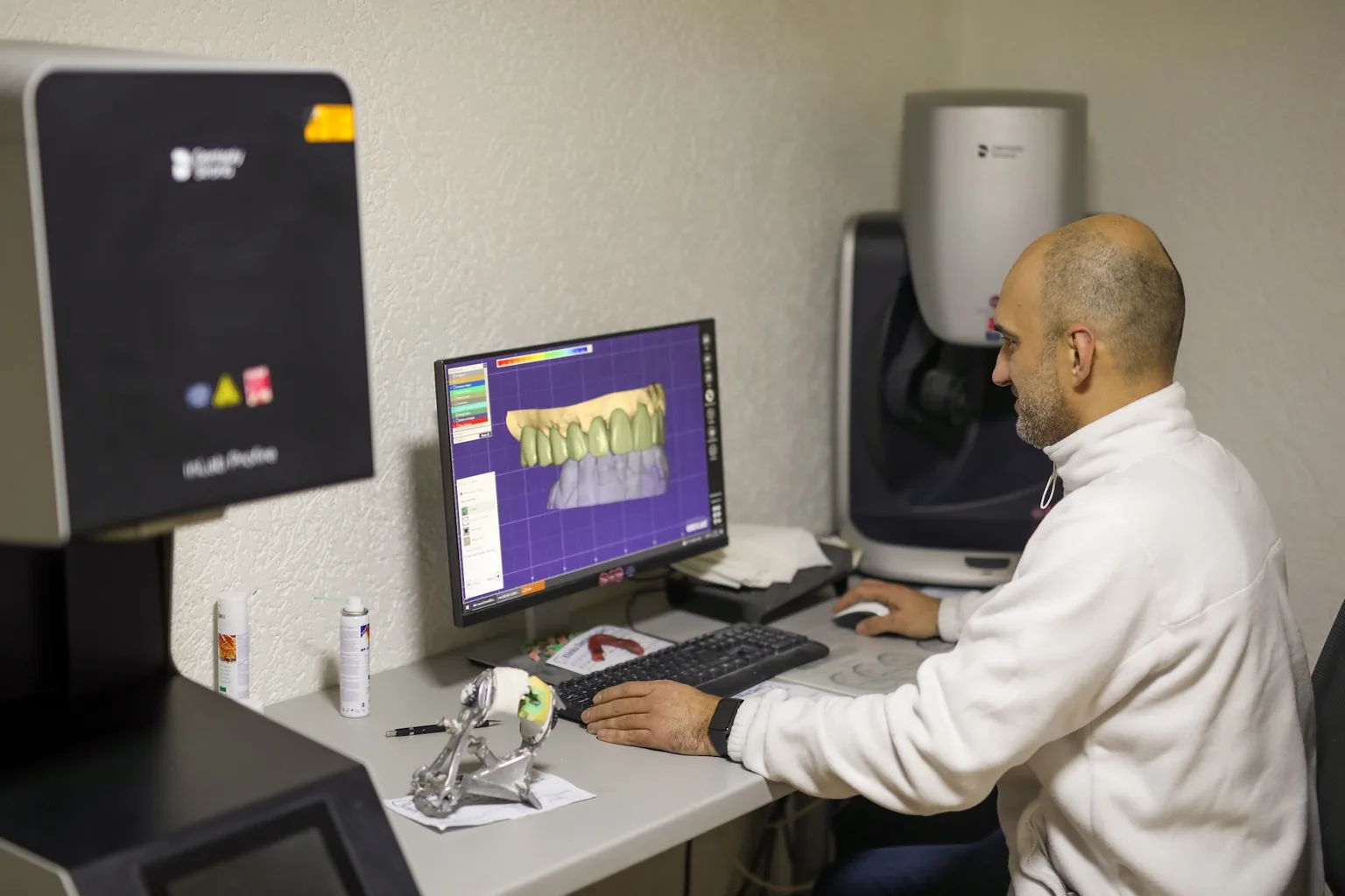 Pajisje moderne të teknologjisë dentare, sisteme dixhitale dentare